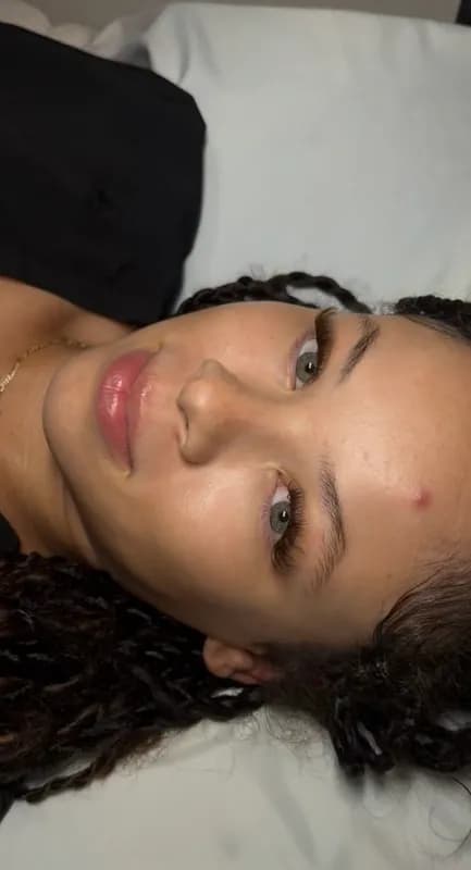 A client with braids showing a lip enhancement and lash extensions